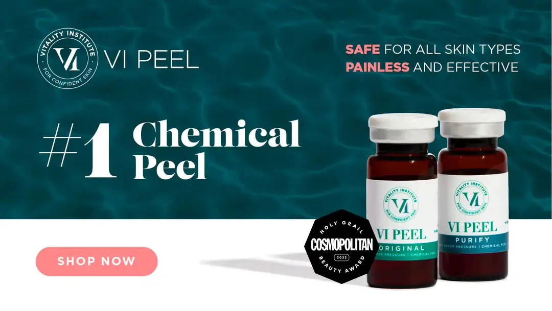 vi chemical peel