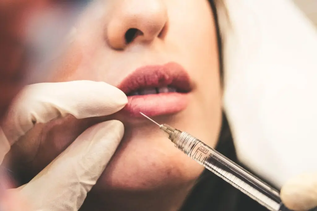 lip filler houston tx